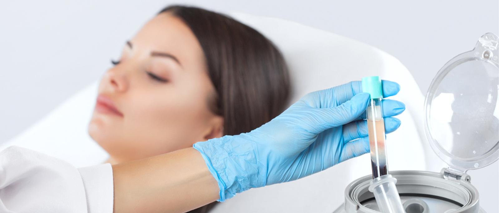 PRP Skin Rejuvenation Treatment - Adore Skin Clinic